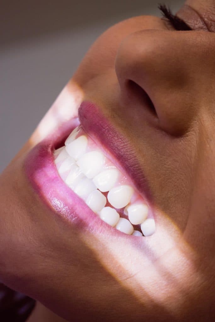 Paciente recibiendo un tratamiento dental estético