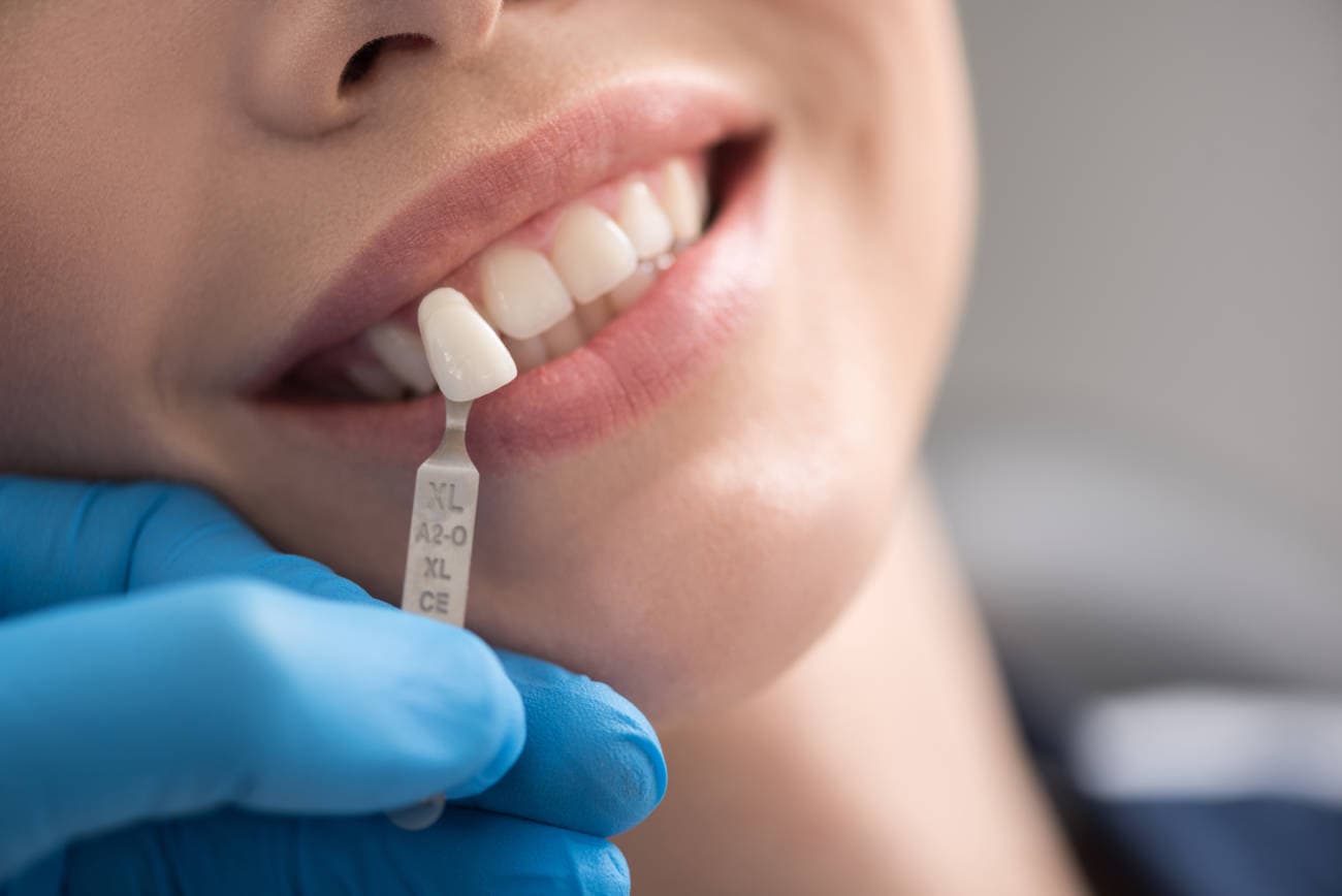 Profesional explicando un tratamiento de implantes dentales